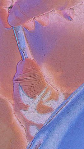 Sounding a 10mm Single ended Hegar