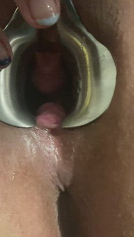 Anal Speculum Breeding Creampie Cum Freeuse Gangbang Gaping Stretching gif