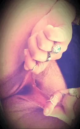 Dangling labia