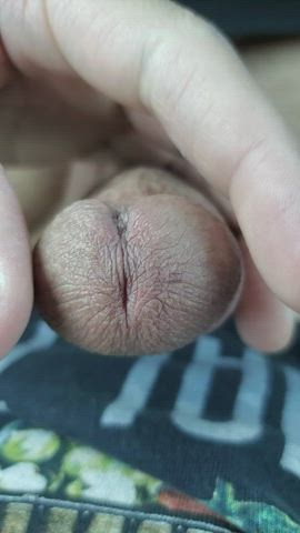 Does anyone else have "lips" around their hole? It almost looks like a