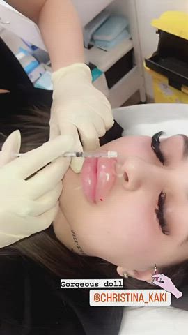 Massive new lips for Christina!
