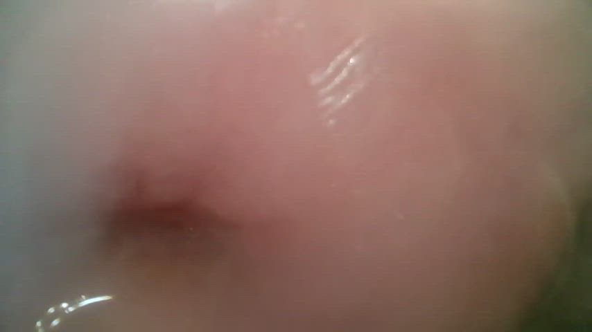 even with 10ml of saline in there, couldn't get a clear view inside