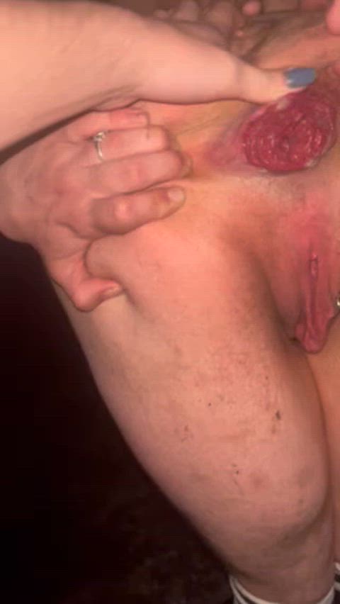 prolapse rosebud trans trans man dirty gif