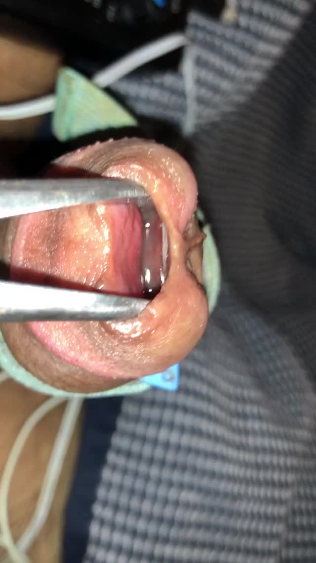 Precum inside my stretched peehole