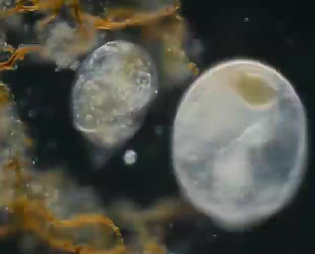 Infusoria Trachelius eats infusoria Campanella