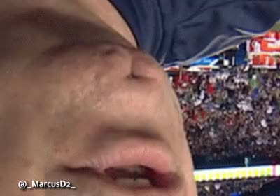 Bill O'Brien chin reversed