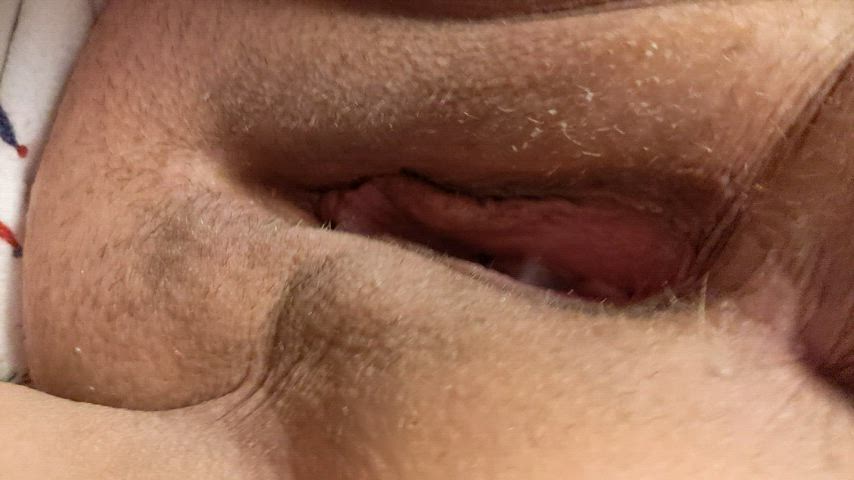 Came deep but still oozing out ☺️
