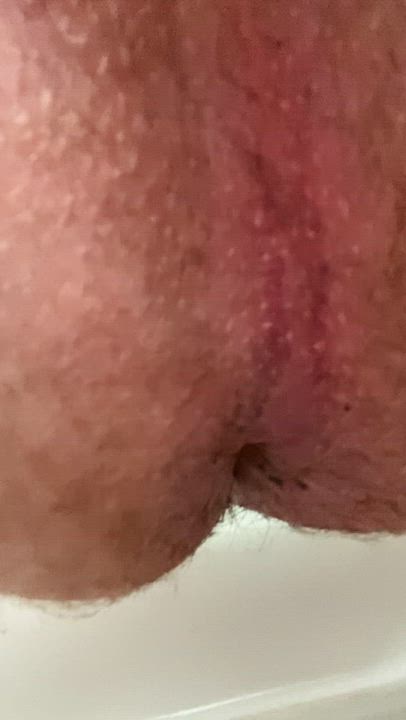 Is this close-up too gross?