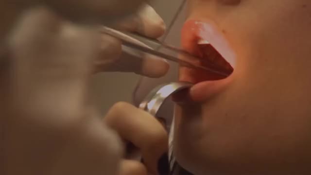 America Dental Clinic: Root Canal Near You