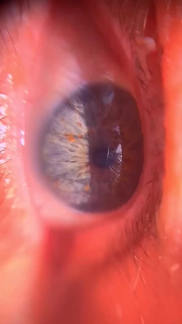 Dad,mom then me??? how are you guys doing today!?? #aesthetic #foryou #eyes