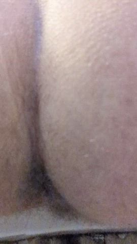 (M) 1st vid after surgery and also first on the new phone, sorry about the bad angle