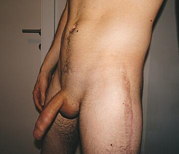 Do you mind scars?