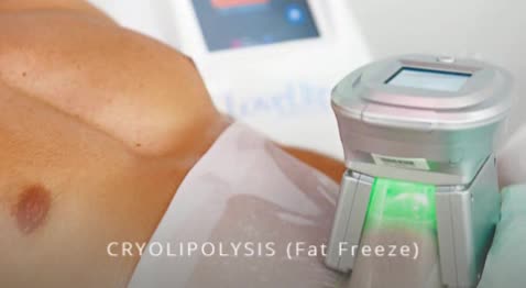 Cryo Lipo Manchester | Rejuvenate Medispa