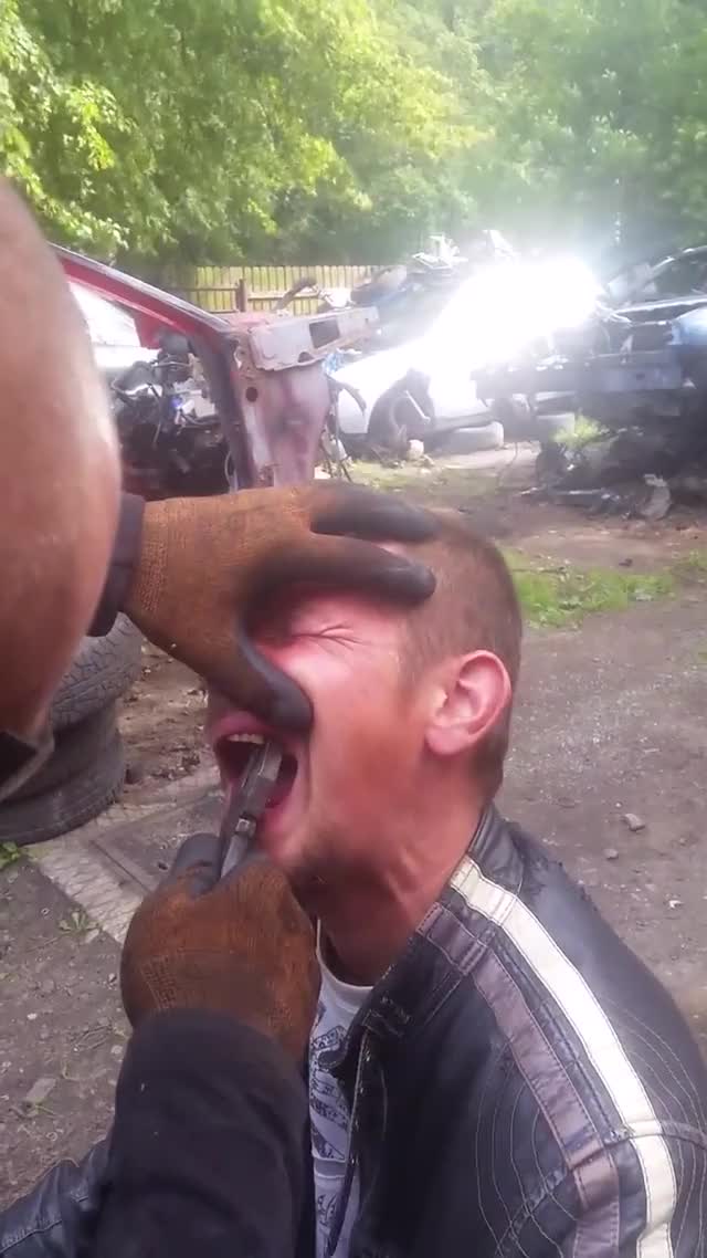 Extracting tooth with pliers polish way
