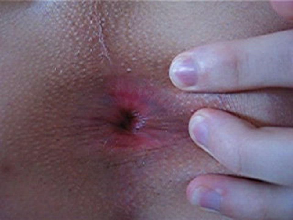 Amateur Anal Anal Play Asshole Close Up Examination Fingering Gaping Homemade gif