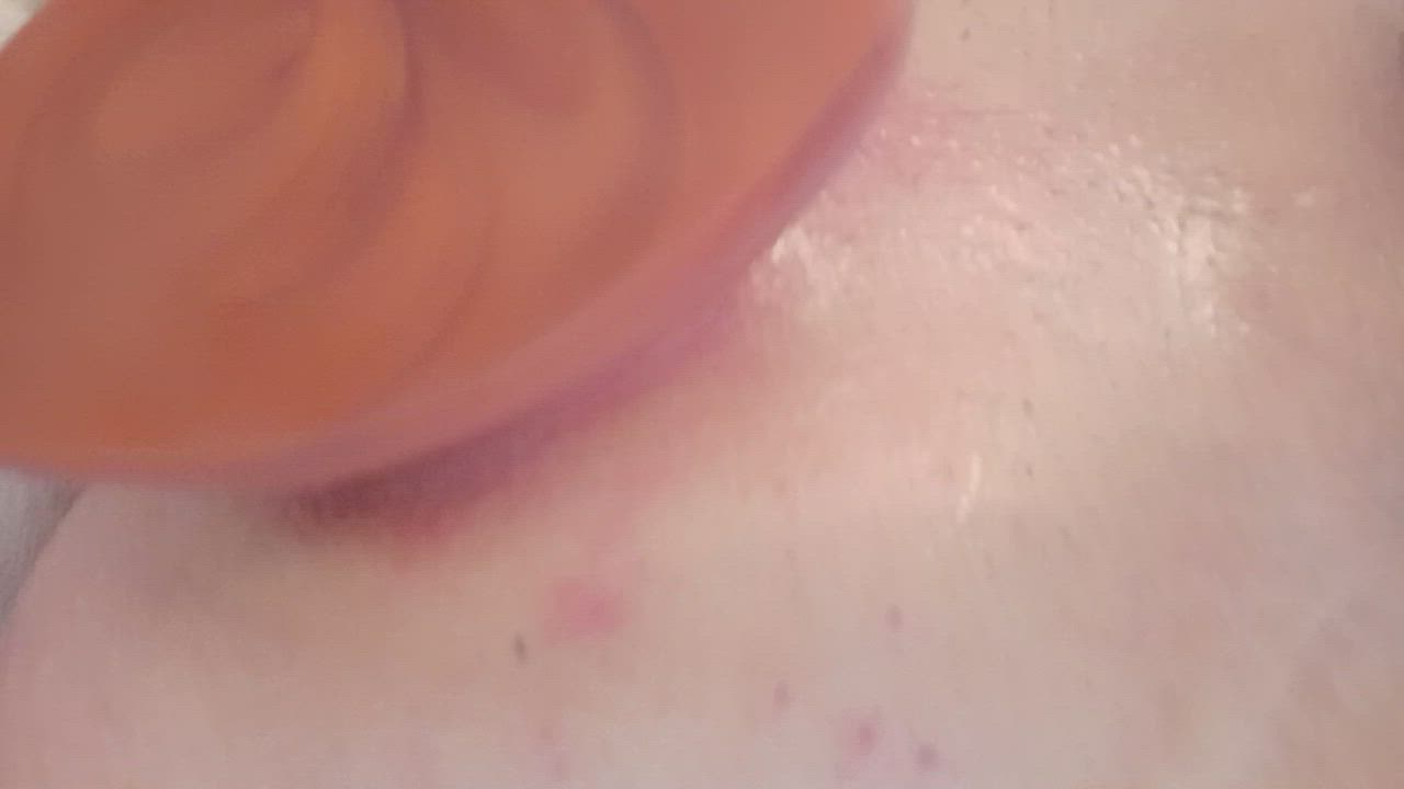 My hole after a couple hours plugged