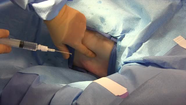 Chest Tube Anesthesia