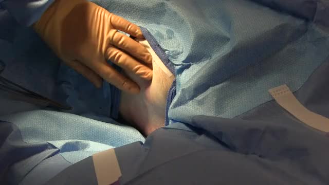 Chest Tube Incision and Kellys
