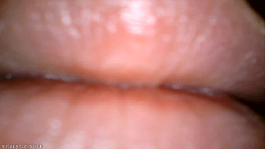 yawning uvula endoscopy